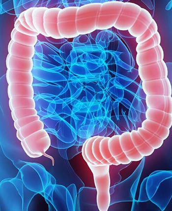 woman colon showing on x ray